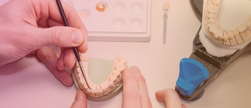 Реставрация зубов в клинике "Свои люди"