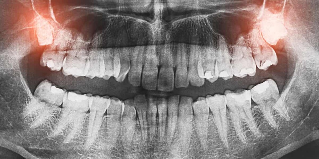 Зубная боль.jpg